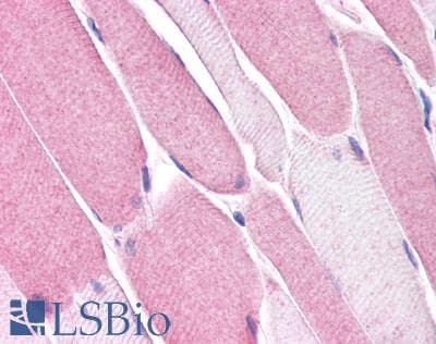 IHC-plus™ VMD2L3 / BEST3 Antibody (Internal)