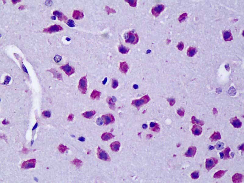 IHC-plus™ CYLD Antibody (aa364-378)