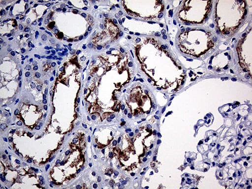 Monoclonal Mouse anti-Human APBB1IP / RIAM Antibody (clone OTI6E3, IHC, WB)
