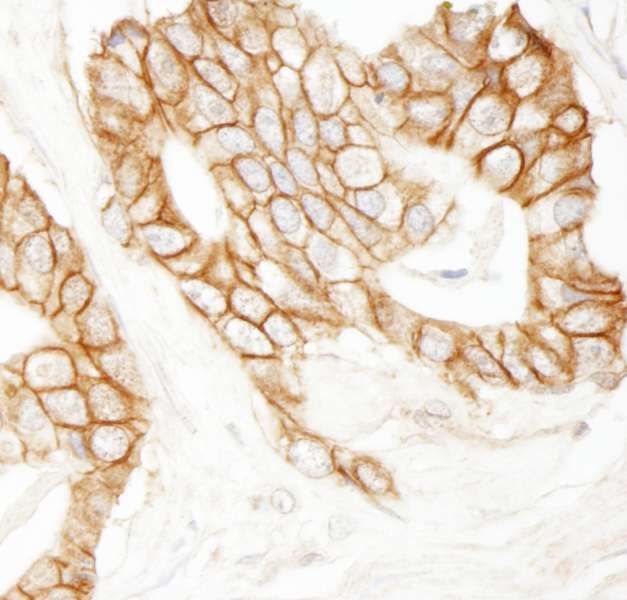 Polyclonal Rabbit anti-Human CTNNB1 / Beta Catenin Antibody (aa760-781, IHC, WB)