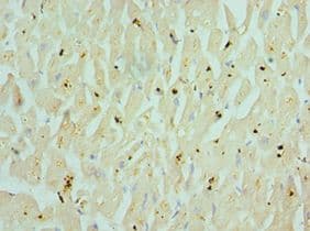 CHRM3 / M3 Antibody (aa270-470)
