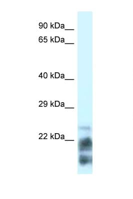 Polyclonal Rabbit anti-Human MDP-1 Antibody (N-Terminus, WB)