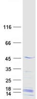 Human MAGEB18 Protein (Recombinant Myc-DDK (Flag))