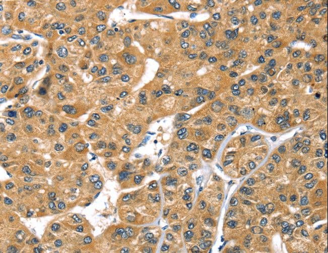 PRSS50 / TSP50 Antibody