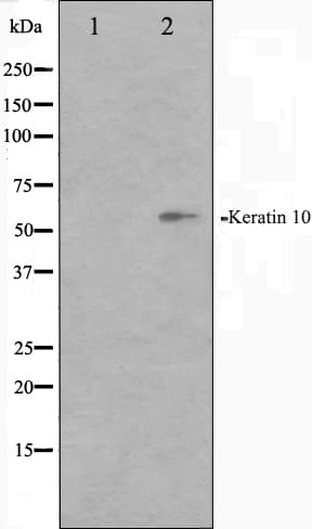 KRT10 / CK10 / Cytokeratin 10 Antibody