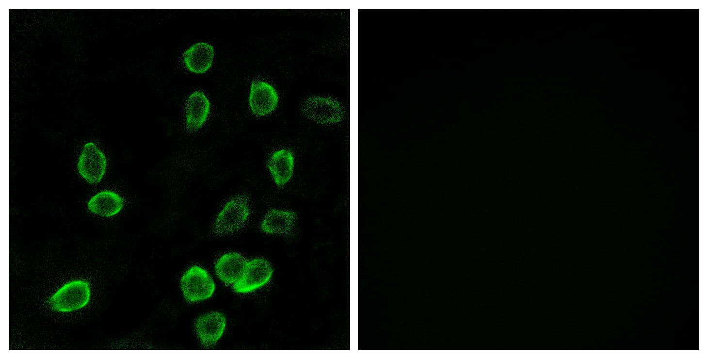 ATP5G3 Antibody (aa1-50)