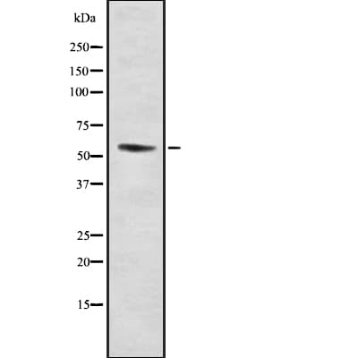 Polyclonal Rabbit anti-Human URI1 / NNX3 Antibody (IHC, IF, WB)