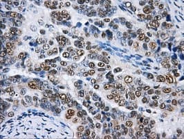 HNRNPF / hnRNP F Antibody (clone OTI5F5)