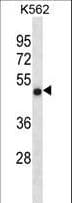 CCDC6 Antibody (aa54-82)