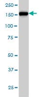 NCAPD2 Antibody (clone 4C12)