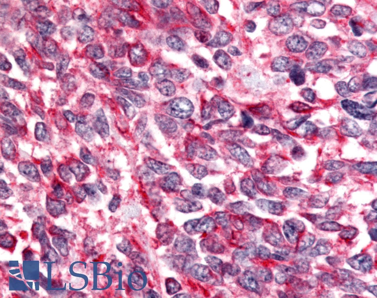 PathPlus™ ADGRB2 / BAI2 Antibody (N-Terminus)