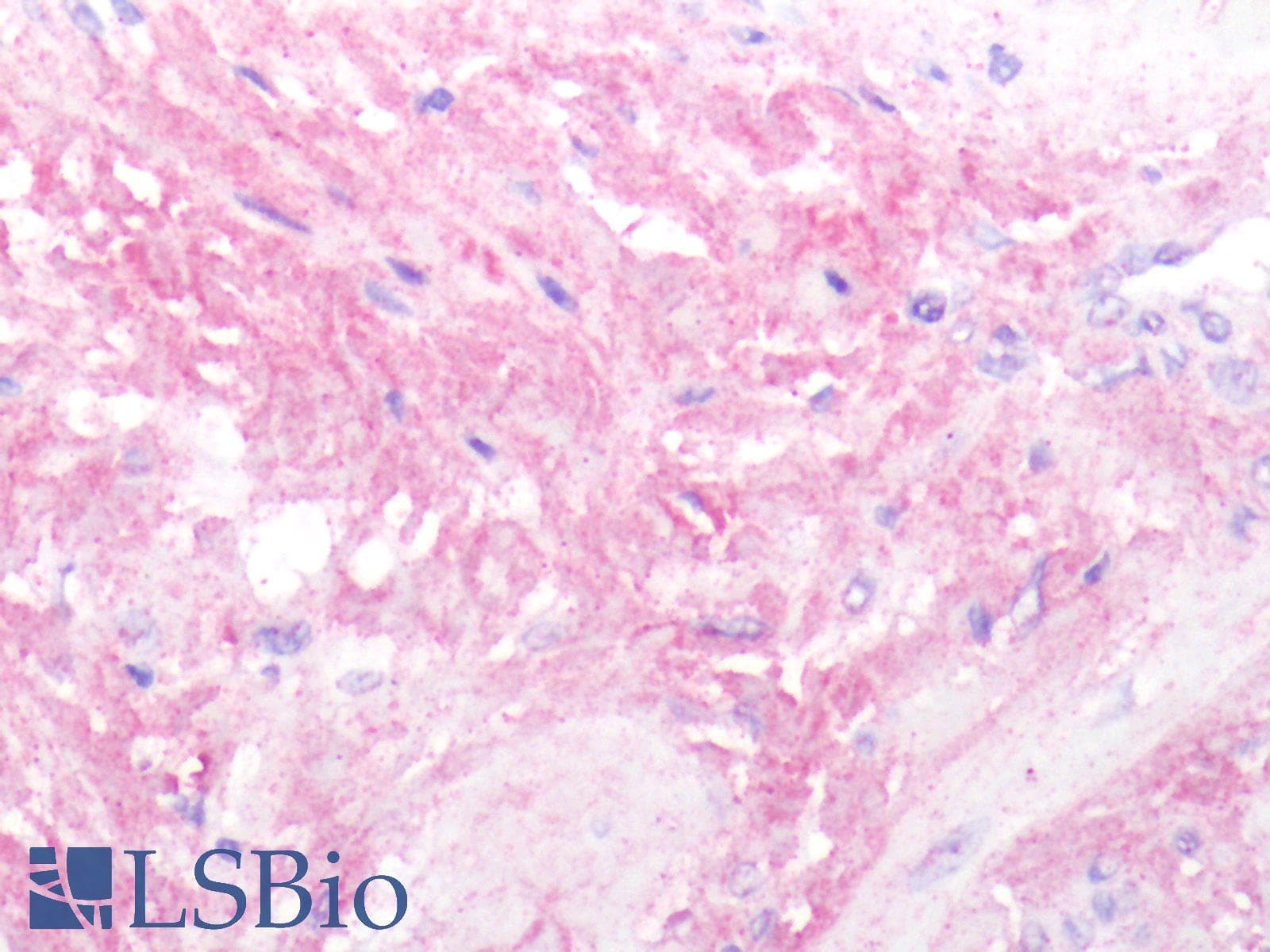 PathPlus™ Polyclonal Rabbit anti-Human OXTR / Oxytocin Receptor Antibody (N-Terminus, IHC)