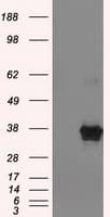 ERCC1 Antibody (clone OTI1A3)