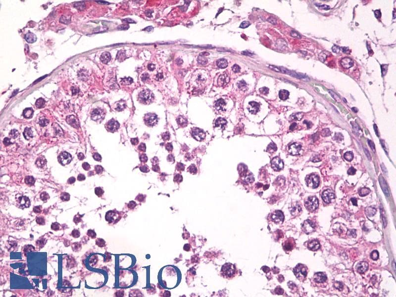 IHC-plus™ Monoclonal Mouse anti-Human TMBIM6 / Bax Inhibitor 1 Antibody (clone 20F565, IHC, WB)