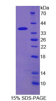 Rat CAMK2G / CaMK II Gamma Protein (Recombinant His)
