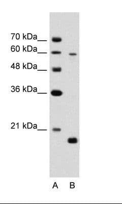 SLC38A4 / SNAT4 Antibody (aa381-430)