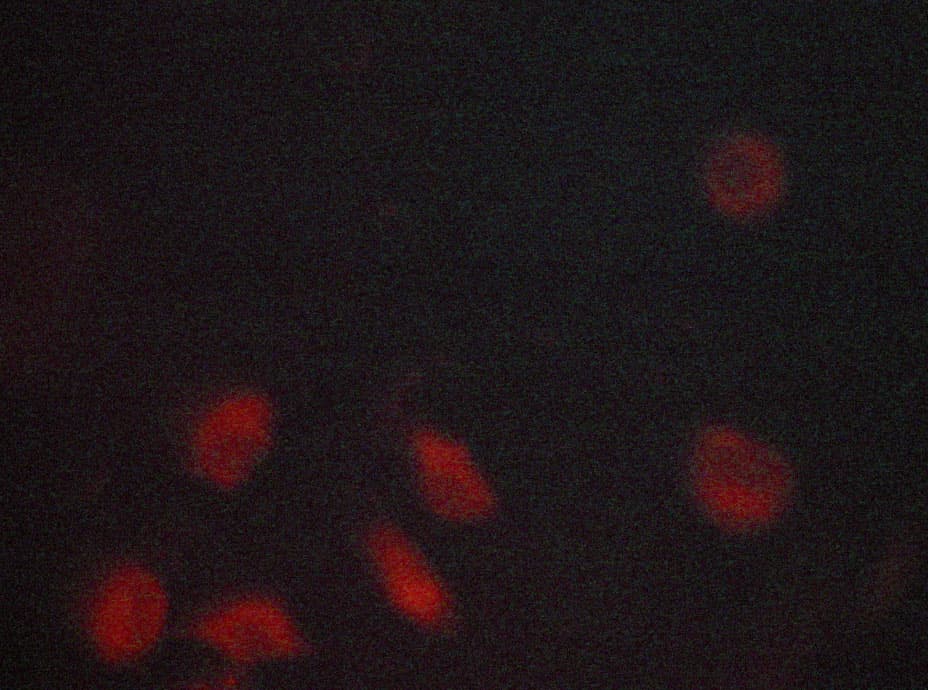 Polyclonal Rabbit anti-Human INSR / Insulin Receptor Antibody (IHC, IF, WB)
