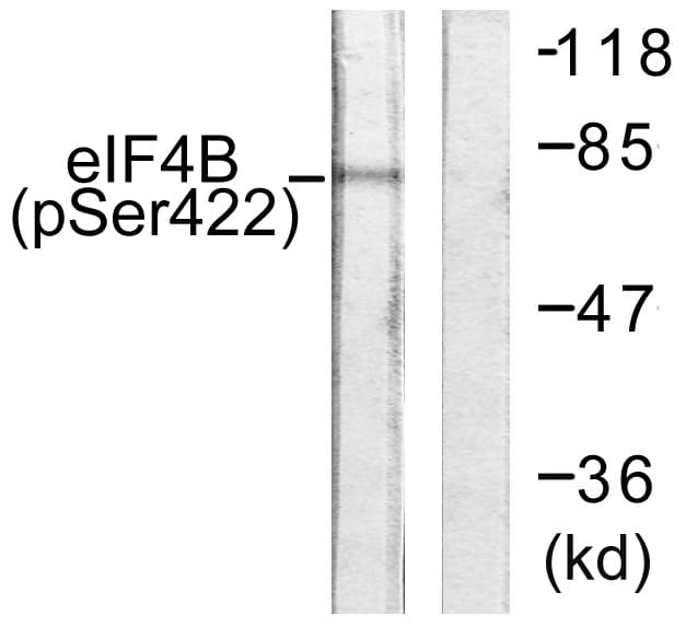 EIF4B Antibody (phospho-Ser422)
