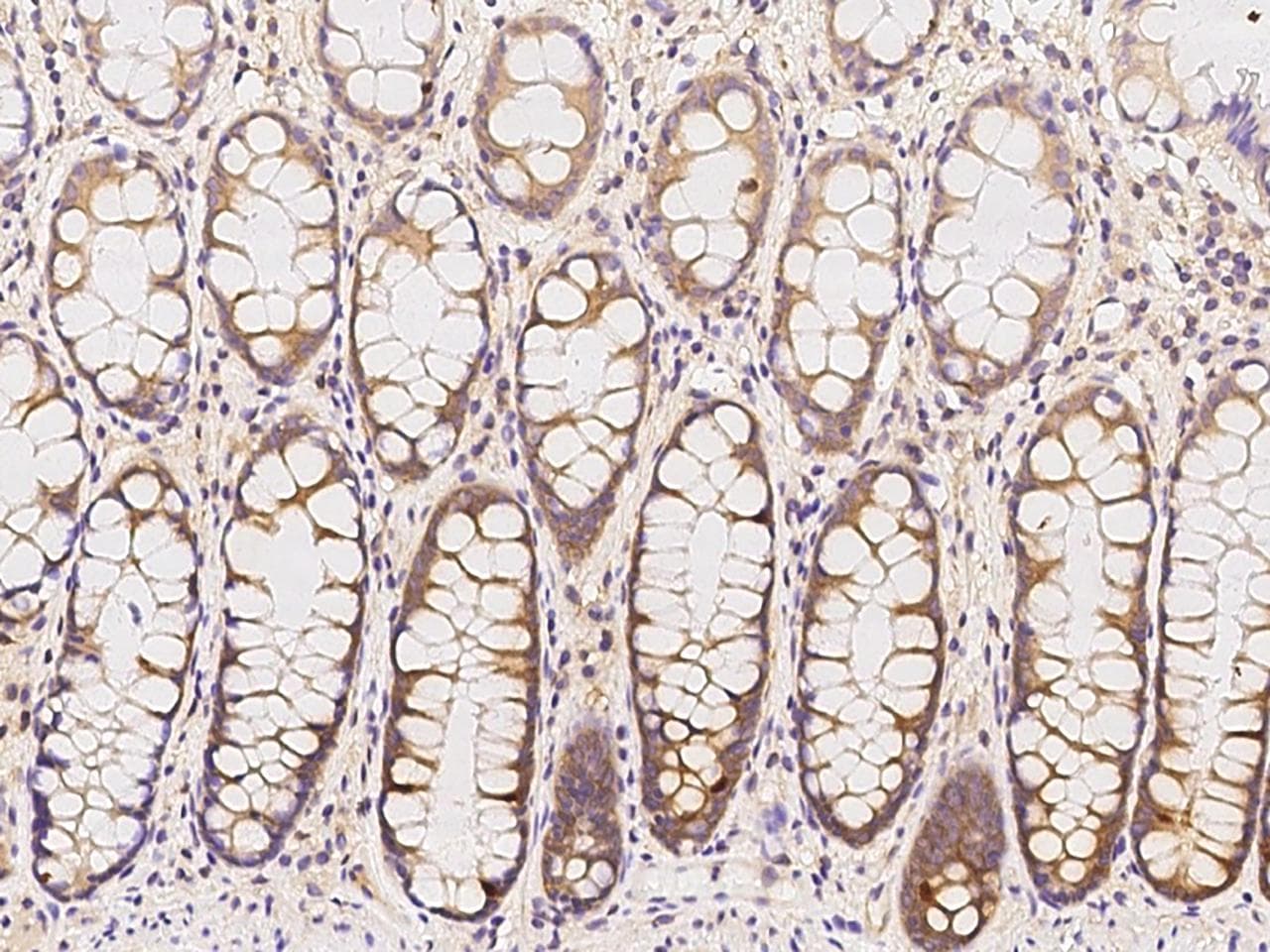 Polyclonal Rabbit anti-Human ASMTL Antibody (IHC)