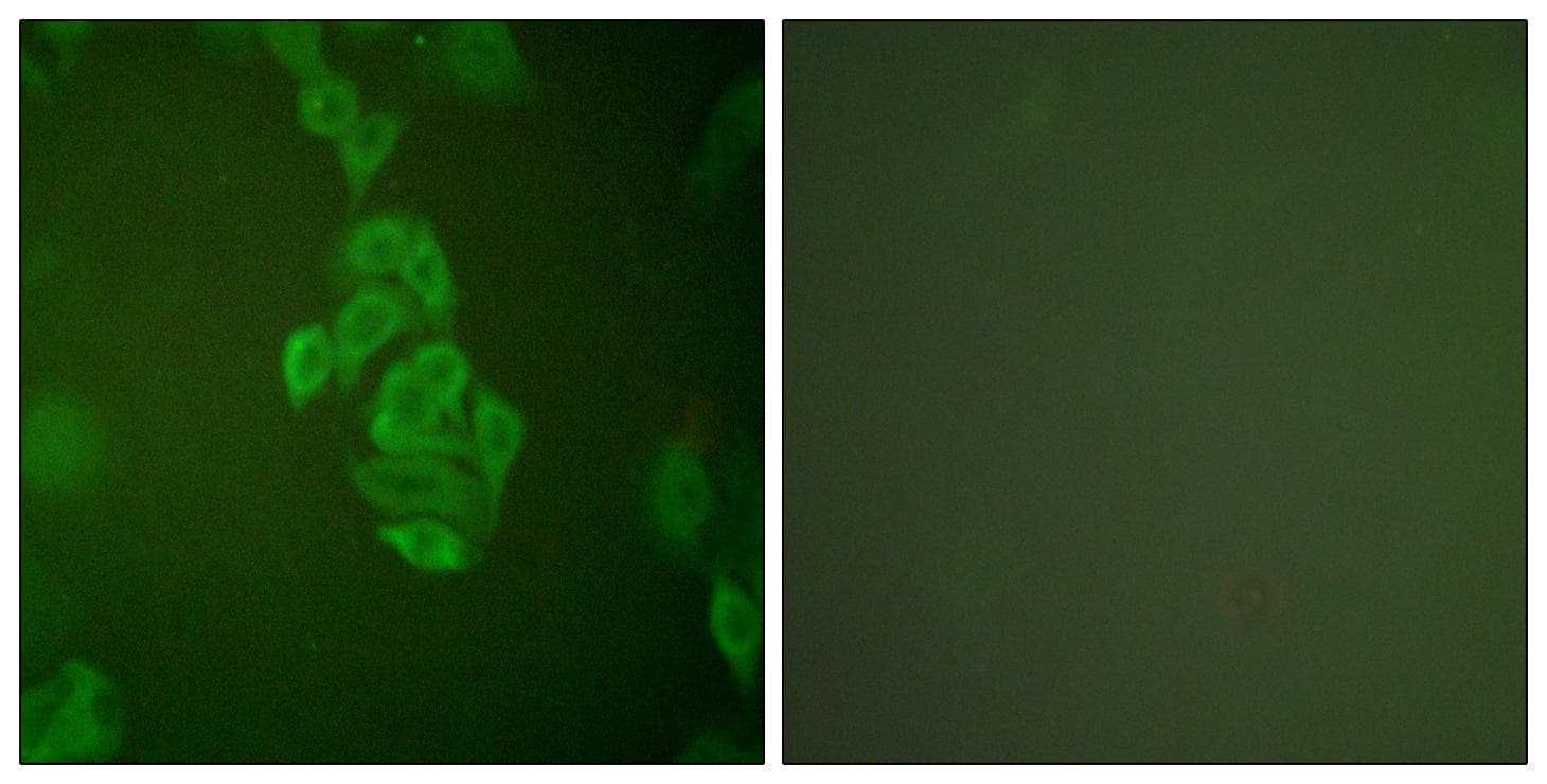 Polyclonal Rabbit anti-Human ENO2 / NSE Antibody (IHC, IF, WB)
