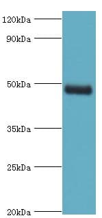 KCNN4 / KCa3.1 Antibody (aa288-427)