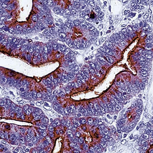 TAG-72 Antibody (clone B72.3)