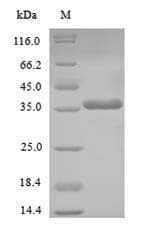 Human NANOG Protein (Recombinant 6His, N-terminus)