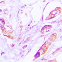 VEGFD Antibody (Internal)