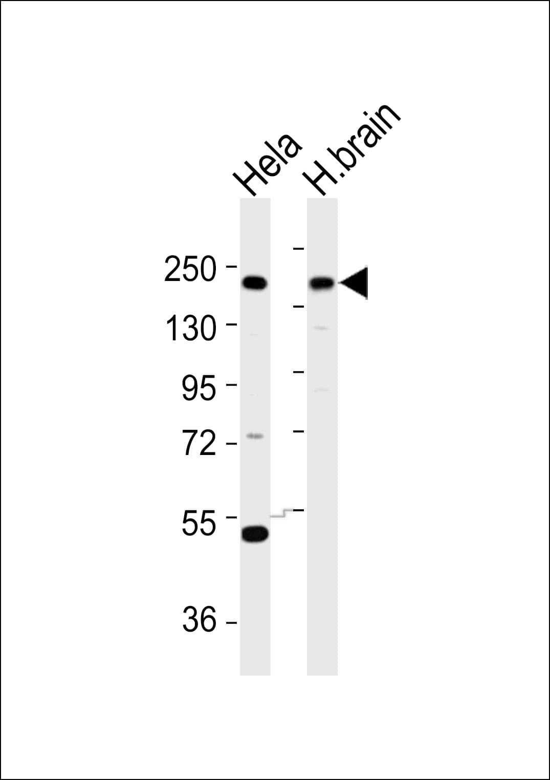 YEATS2 Antibody