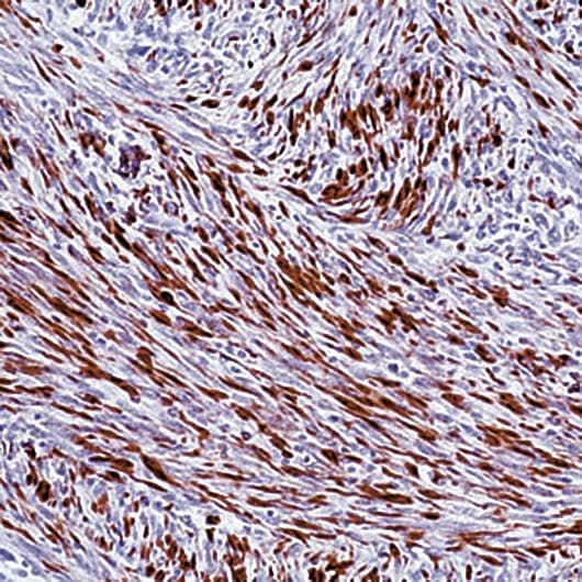 DES / Desmin Antibody (clone D33)