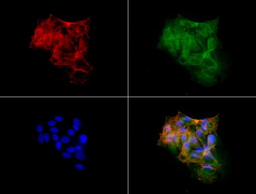 HP / Haptoglobin Antibody (clone UMAB10)