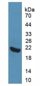 Rat IL1R1 Protein (Recombinant His, N-Terminal)