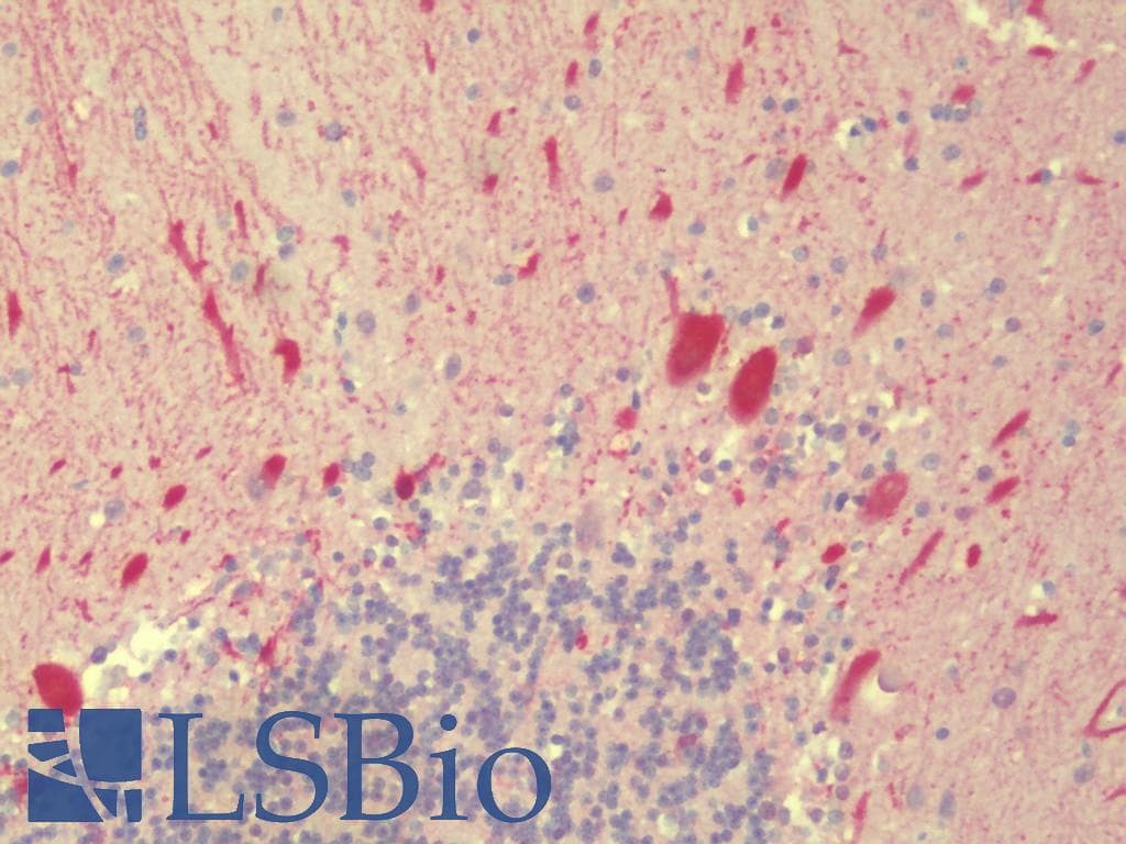 IHC-plus™ KCNK12 Antibody