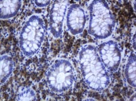 RAB21 Antibody (clone OTI5B12)
