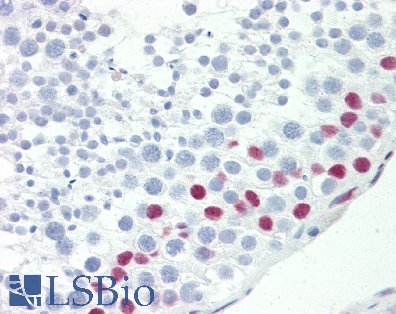 IHC-plus™ TCEAL3 Antibody (aa15-43)