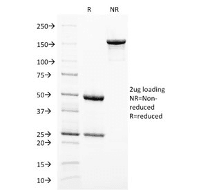 Monoclonal Mouse anti-Human PMEL / SILV / gp100 Antibody (clone PMEL/2038, IHC)