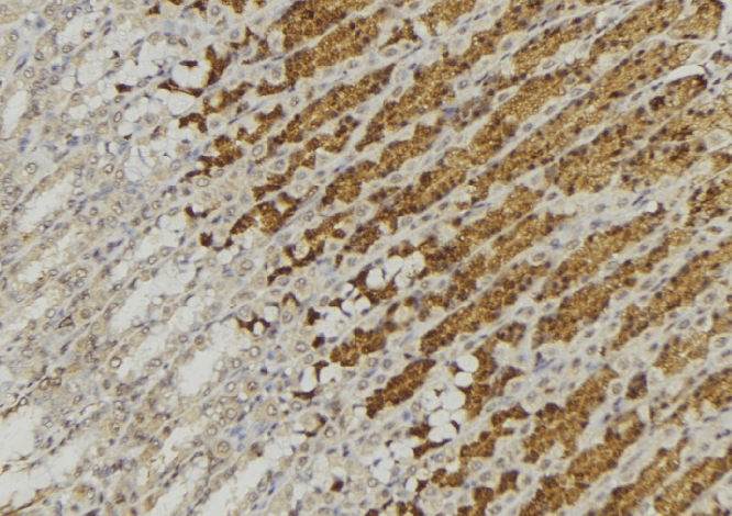 Polyclonal Rabbit anti-Human CTSA / Cathepsin A Antibody (IHC, WB)