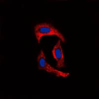 Polyclonal Rabbit anti-Human MMP1 Antibody (C-Terminus, IHC, IF, WB)