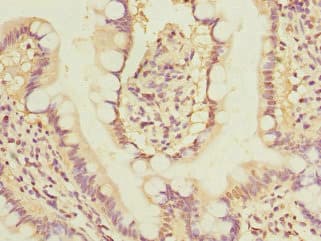 Polyclonal Rabbit anti-Human GLP2R Antibody (IHC)