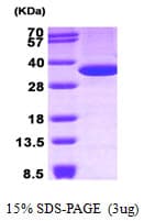 Human ANXA5 / Annexin V Protein (Recombinant)