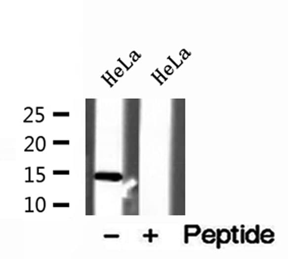 Polyclonal Rabbit anti-Human UQCRB Antibody (IHC, IF, WB)