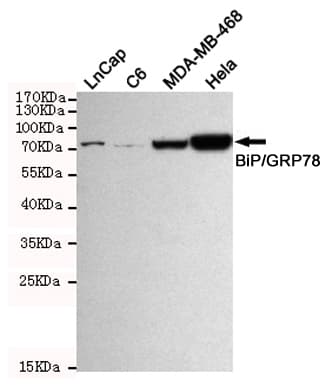 Monoclonal Mouse anti-Human HSPA5 / GRP78 / BiP Antibody (IHC, WB)