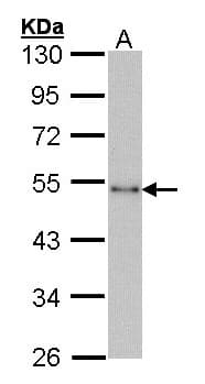 CTBP1 / CTBP Antibody (aa194-379)