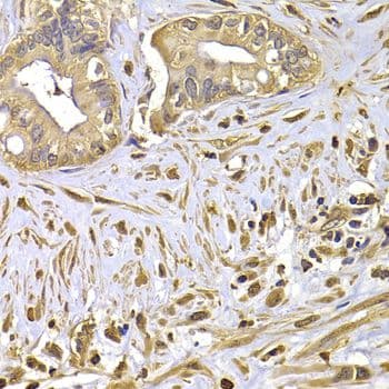 FSCN1 / Fascin Antibody
