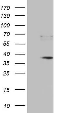 Monoclonal Mouse anti-Human PRTN3 / Myeloblastin Antibody (clone OTI6A10, aa28-248, WB)