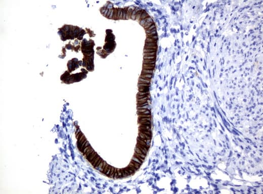 Monoclonal Mouse anti-Human KRT18 / CK18 / Cytokeratin 18 Antibody (clone UMAB50, Carrier-free, aa69-372, IHC, IF, WB)
