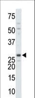 Polyclonal Rabbit anti-Human Thymidylate Kinase Antibody (aa164-194, WB)