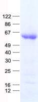 Human EED Protein (Recombinant His, N-Terminal)
