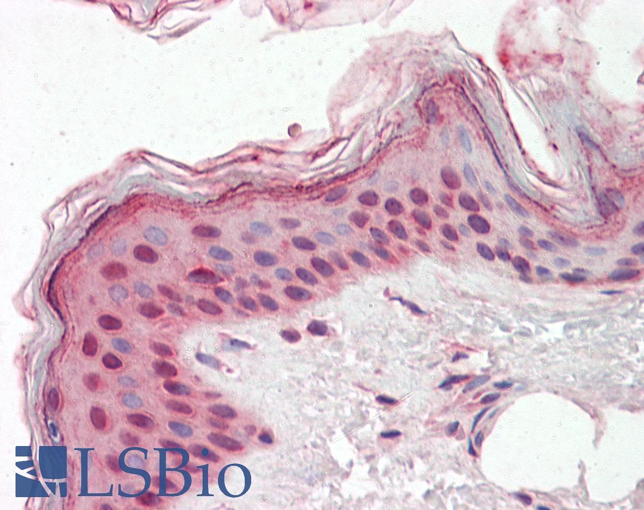 IHC-plus™ Monoclonal Mouse anti-Human IMP-3 / IGF2BP3 Antibody (clone 8F11, IHC, WB)