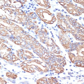 KRT18 / CK18 / Cytokeratin 18 Antibody